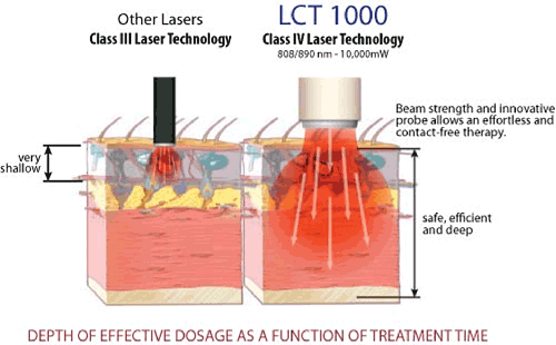 How laser therapy works